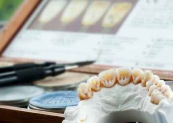 Dental Bridges vs. Dental Crowns