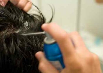 Hair Restoration Services