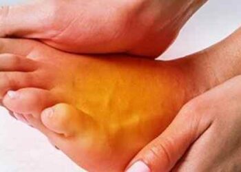 Why You Should Treat Underlying Health Conditions to Curb Foot Discoloration