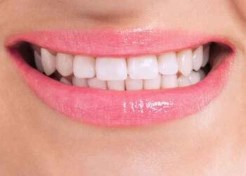 Teeth Whitening Options To Give Your Discolored Teeth a Sparkle