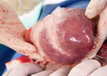 You No Longer Have to Fear Open-Heart Surgery