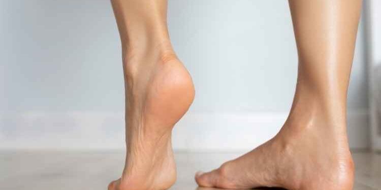 The Reason You Have Flat Feet