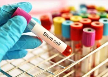 What Are the Benefits of Stem Cell Banking