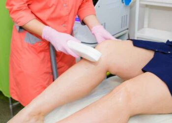 A Detailed Account on Laser Hair Removal
