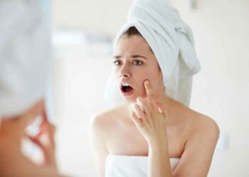 Everything You Need to Know About Acne