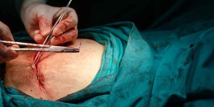 Top-Notch Hysterectomy facility in Virginia