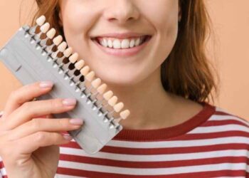 Veneer Placement as a Dental Option