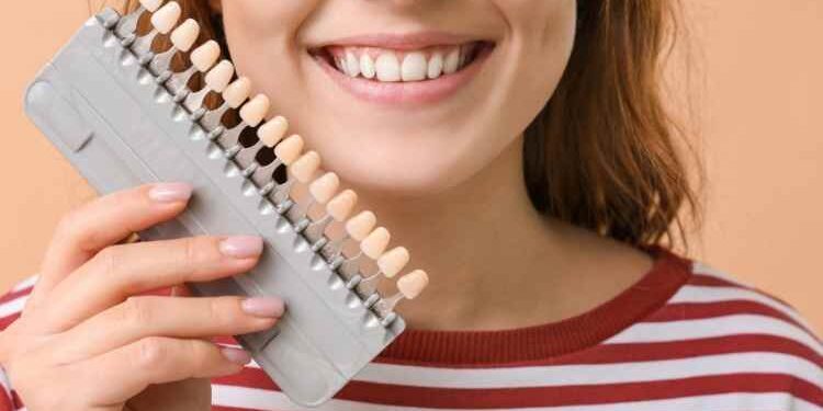 Veneer Placement as a Dental Option