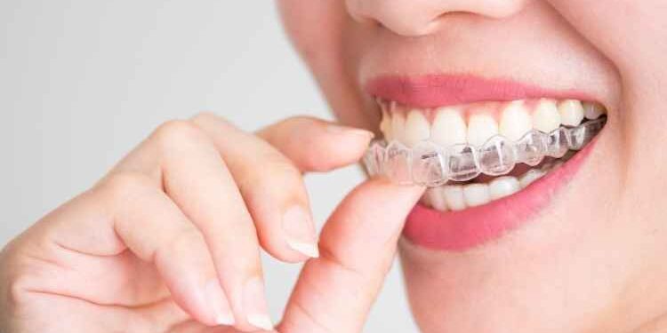 Looking for Invisalign Treatment