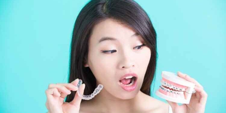 What Are the Different Types of Dental Braces That Exist Today