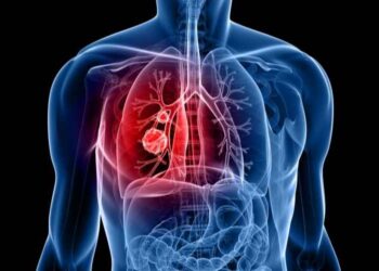 7 Steps You Can Take to Lower Your Risk of Lung Cancer