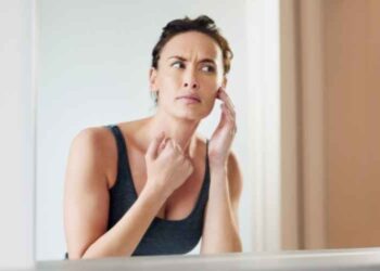 How Can I Find the Best Acne Treatment for Teens