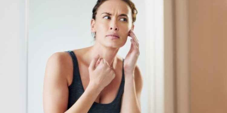How Can I Find the Best Acne Treatment for Teens