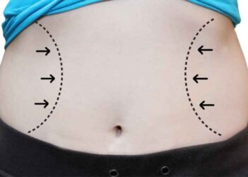 Nervous About Getting Liposuction In Las Vegas