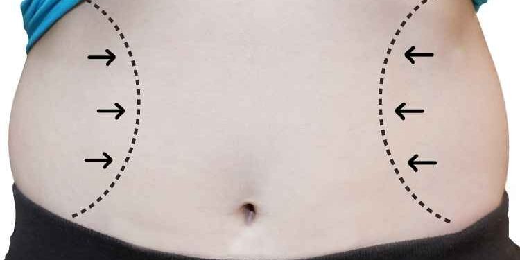 Nervous About Getting Liposuction In Las Vegas