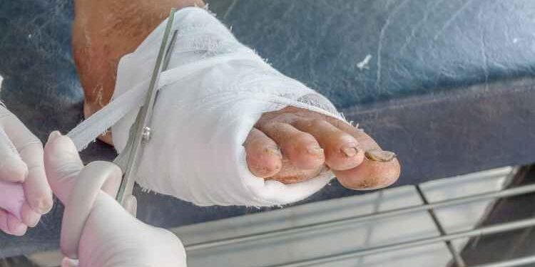 How to Manage Diabetic Foot at Home