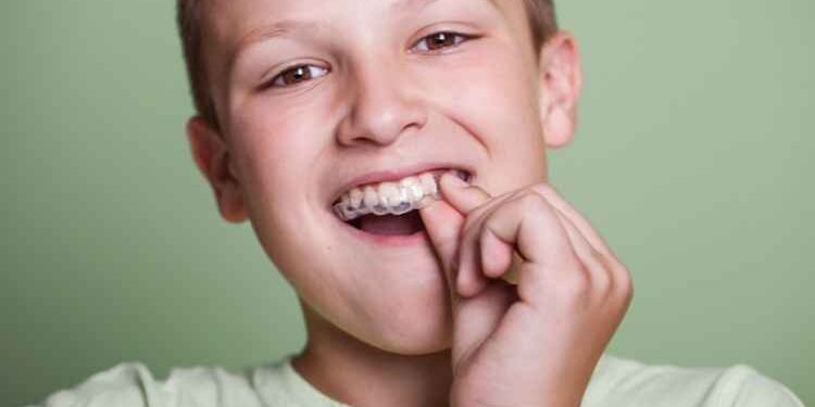 The Different Types of Mouth Guards to Protect Your Teeth