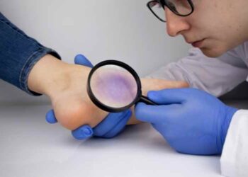 Why You Should Visit A Vascular Surgeon