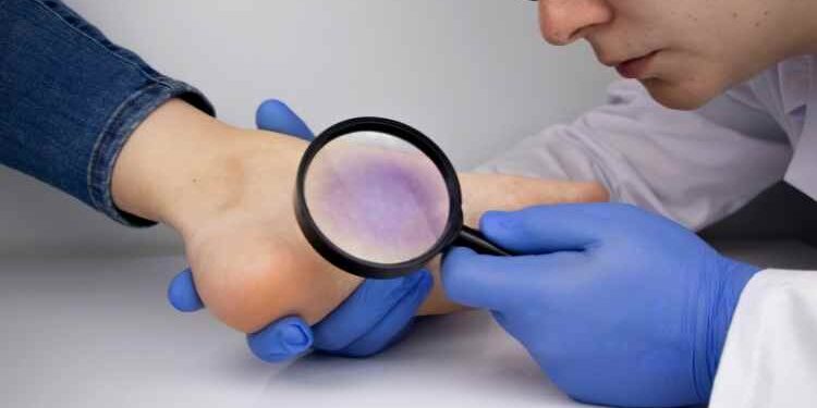 Why You Should Visit A Vascular Surgeon