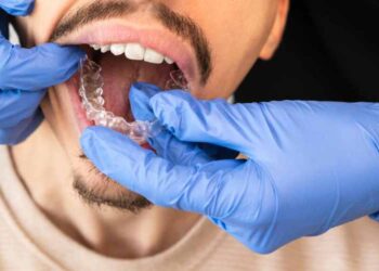 The Role of an Invisalign Specialist in Orthodontic Care