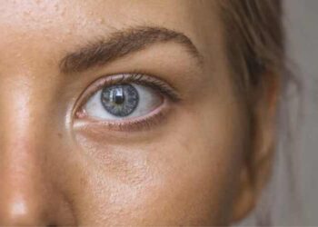 6 Expert Tips for Reducing Bags Under Your Eyes