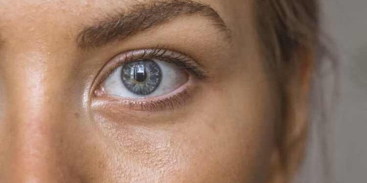 6 Expert Tips for Reducing Bags Under Your Eyes