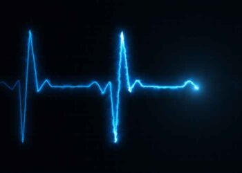 Electromyography (EMG) Diagnosing Motor Nerves and Muscles