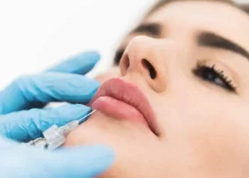 Achieve Fuller Lips Safely And Beautifully With Lip Fillers In Miami