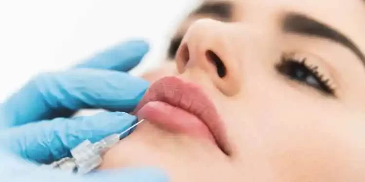 Achieve Fuller Lips Safely And Beautifully With Lip Fillers In Miami